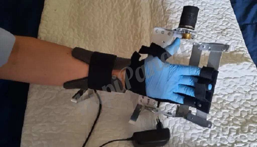 Тренажер для руки после инсульта, ранения, травмы, операции