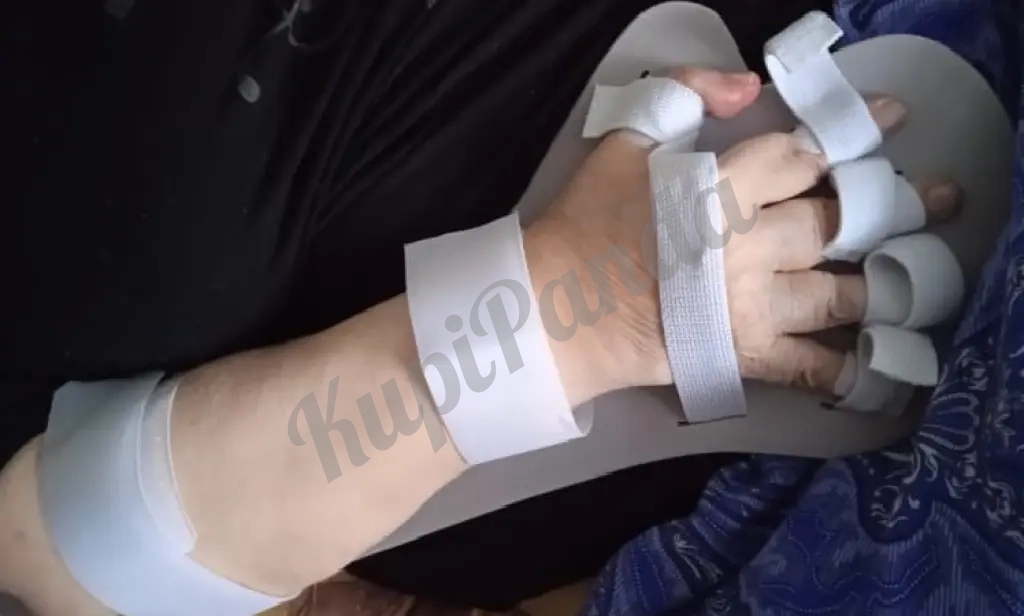 Фиксатор, ортез для руки после инсульта