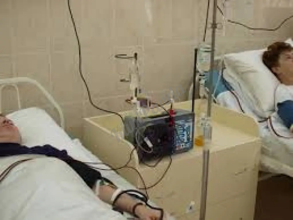 Лечебный мембранный плазмаферез