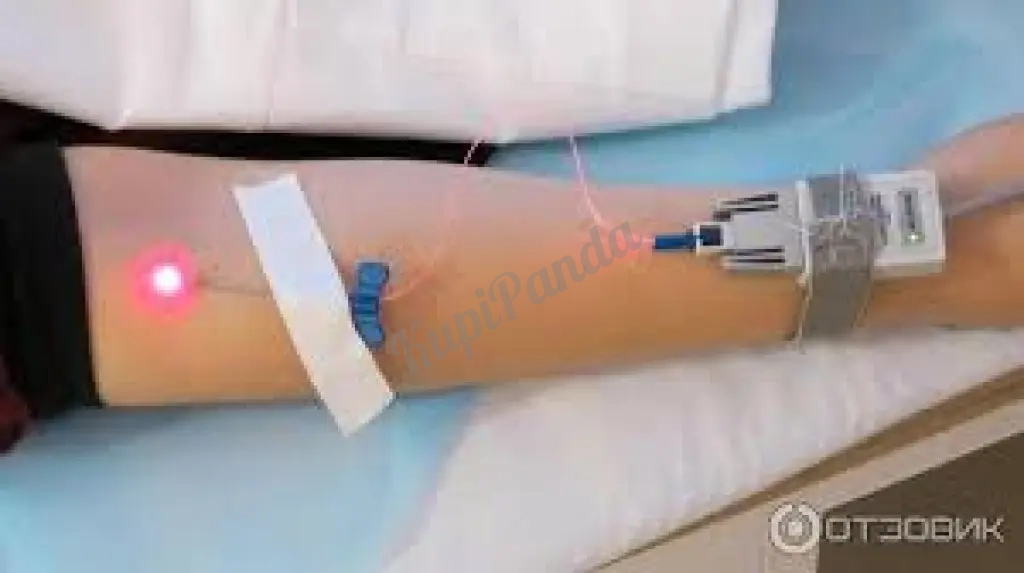 Лазерное и ультрафиолетовое облучение крови.